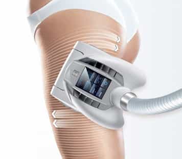 Non-invasive fat reduction treatment at Marie France