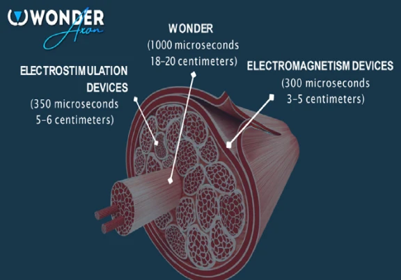 wonder.webp